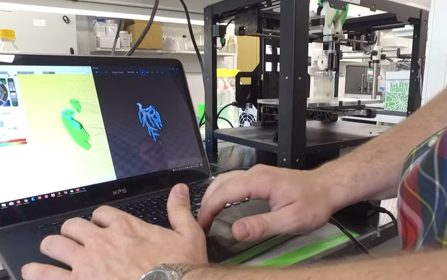 Já é possível criar válvula de coração com impressão 3D