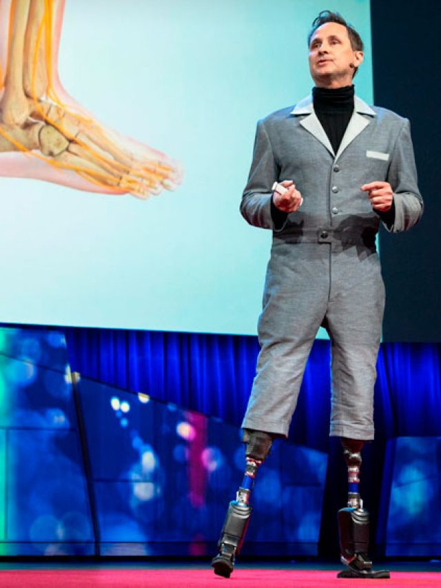 Você trocaria seu corpo por um novo artificial melhor?