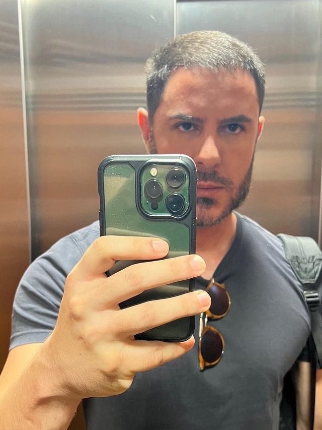 Ricardo Tozzi fez Harmonização facial? Entenda