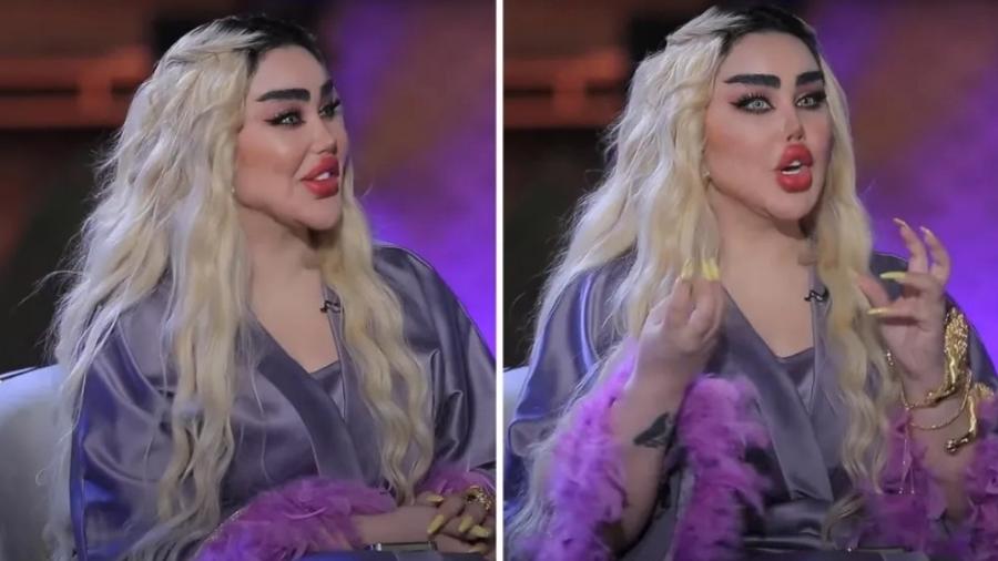 Uma mulher iraquiana realizou 43 cirurgias plásticas para se assemelhar à boneca Barbie.