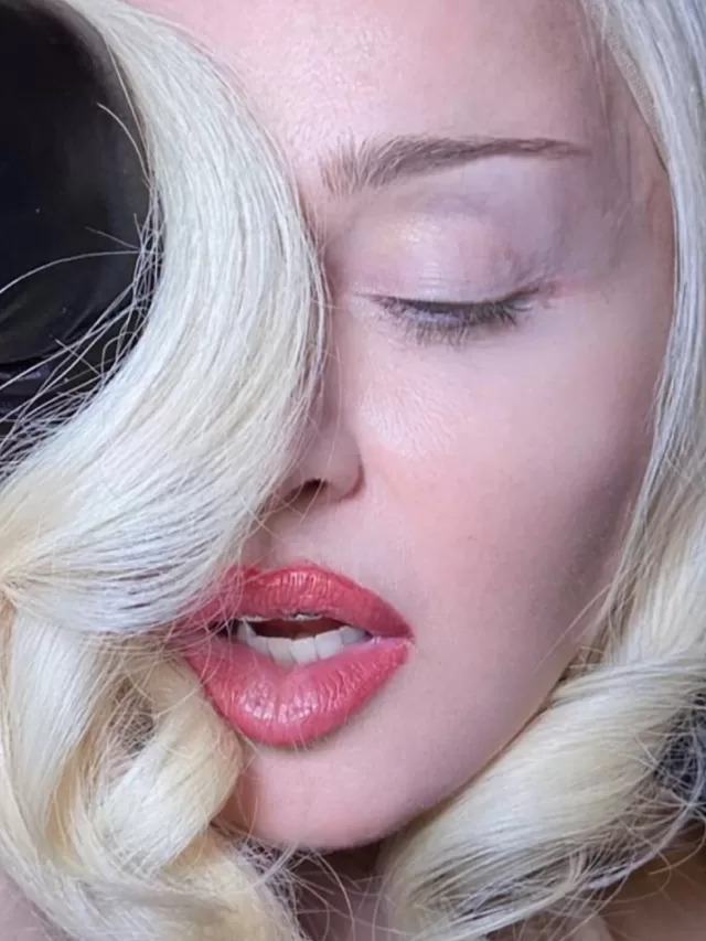 Estado de saúde de Madonna preocupa fãs; entenda o caso